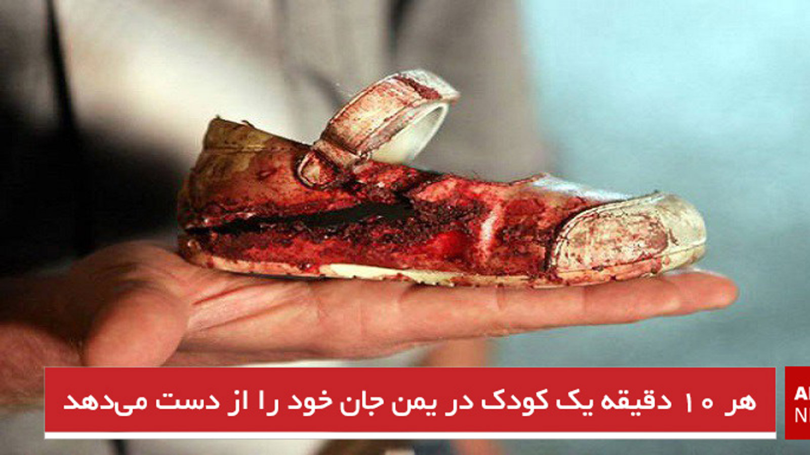 هر ۱۰ دقیقه یک کودک در یمن جان خود را از دست می‌دهد