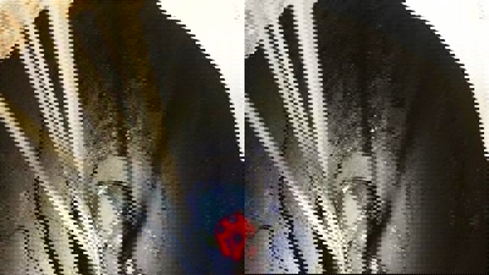 یک پیرزن ۶۰ ساله بطور معجزه آسایی از مرگ نجات یافت