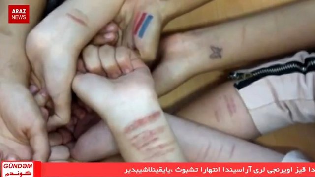 برنامه گوندم از آرازنیوز تی وی - ۱۵ دی ۱۳۹۵