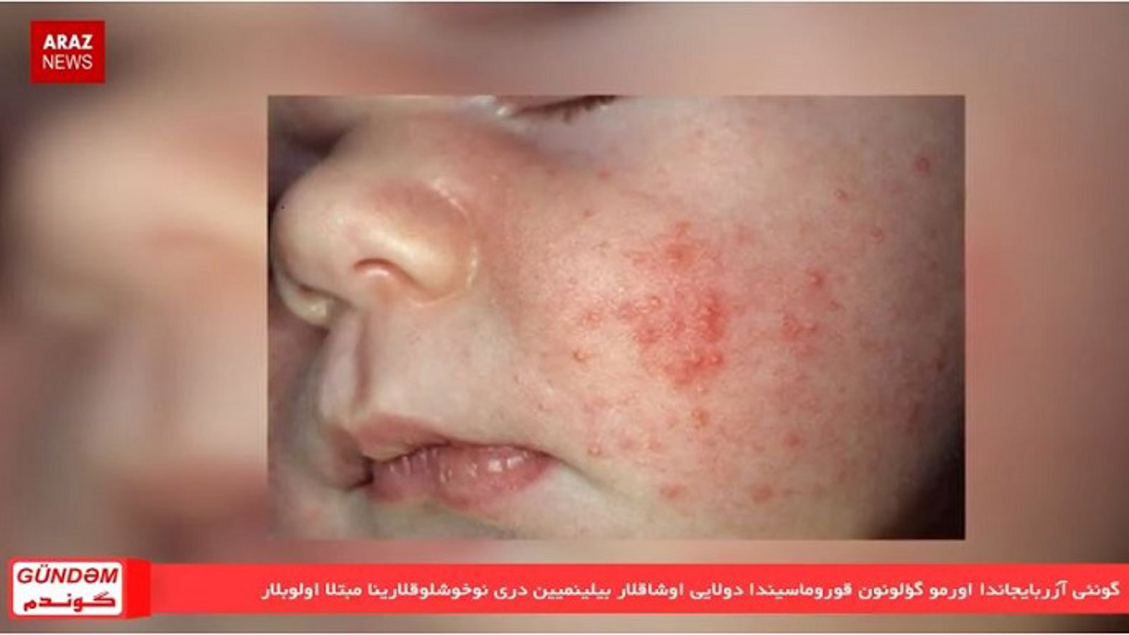 گوندم خبر پروقرامی؛ ۱۷ اردیبهشت ۹۷