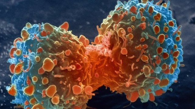 سایه سرطان پوست و ریه بر سر آزربایجان